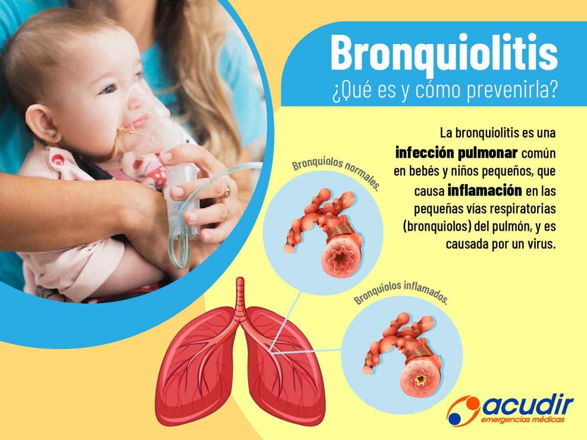 08-07-Bronquiolitis_FB-1-1200x900.jpg