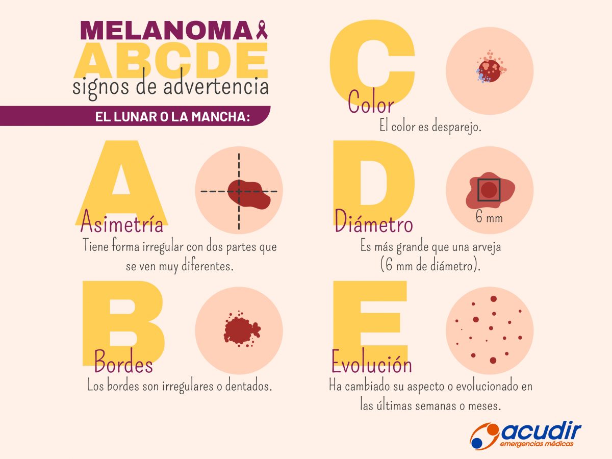 13-06-infografia-cancer-de-piel_Mesa-de-trabajo-1-copia-1200x900.jpg