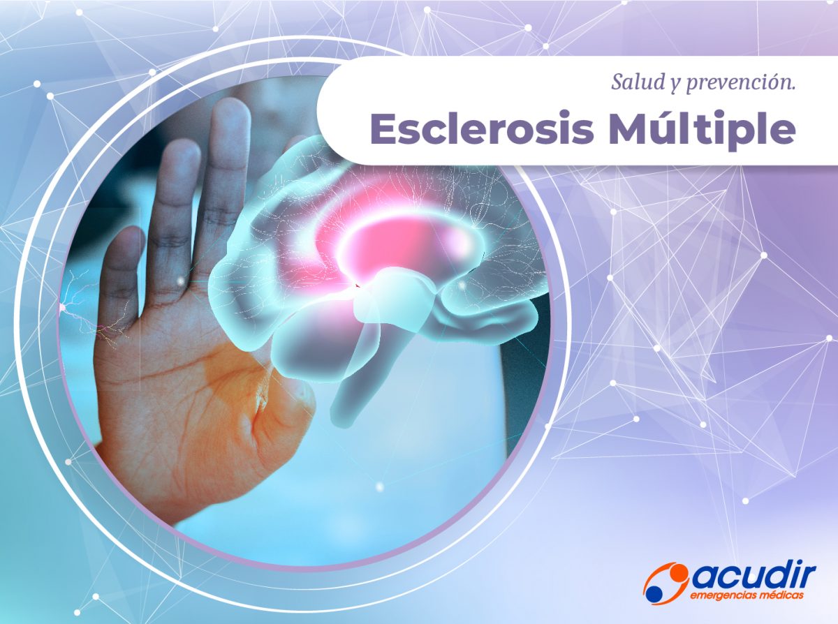18-12-Esclerosis-Multiple_WEB-1200x894.jpg